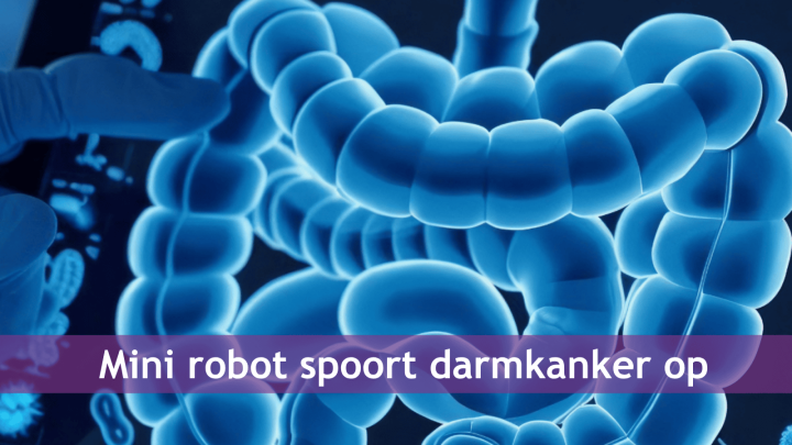 Mini robot spoort darmkanker op