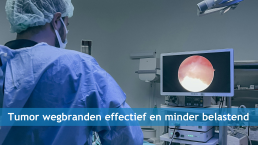 Tumor wegbranden